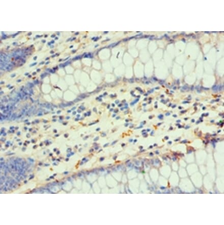 Immunohistochemistry - DLX3 Polyclonal Antibody from Signalway Antibody (42149) - Antibodies.com