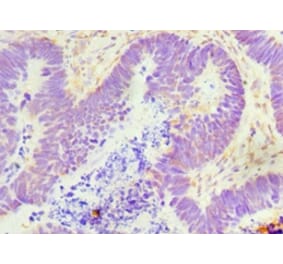 Immunohistochemistry - GDF5 Polyclonal Antibody from Signalway Antibody (42177) - Antibodies.com