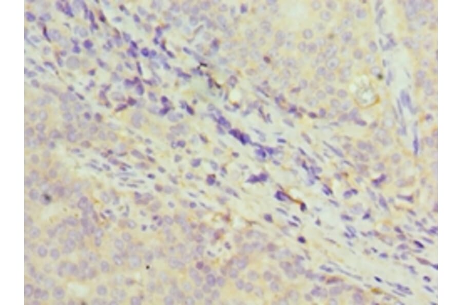 Immunohistochemistry - GDF5 Polyclonal Antibody from Signalway Antibody (42177) - Antibodies.com