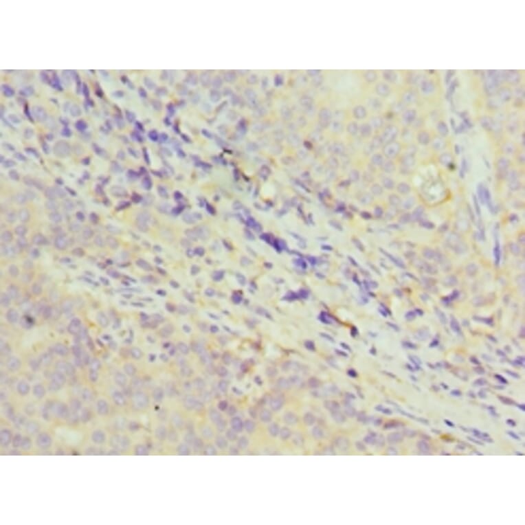 Immunohistochemistry - GDF5 Polyclonal Antibody from Signalway Antibody (42177) - Antibodies.com