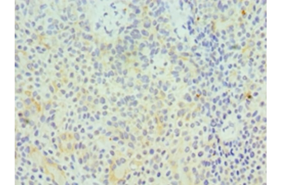 Immunohistochemistry - GZMA Polyclonal Antibody from Signalway Antibody (42195) - Antibodies.com