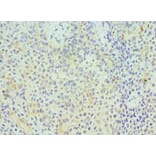 Immunohistochemistry - GZMA Polyclonal Antibody from Signalway Antibody (42195) - Antibodies.com