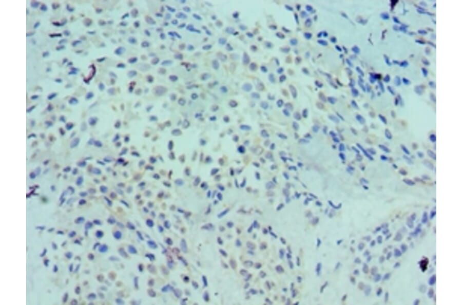 Immunohistochemistry - LRP6 Polyclonal Antibody from Signalway Antibody (42243) - Antibodies.com