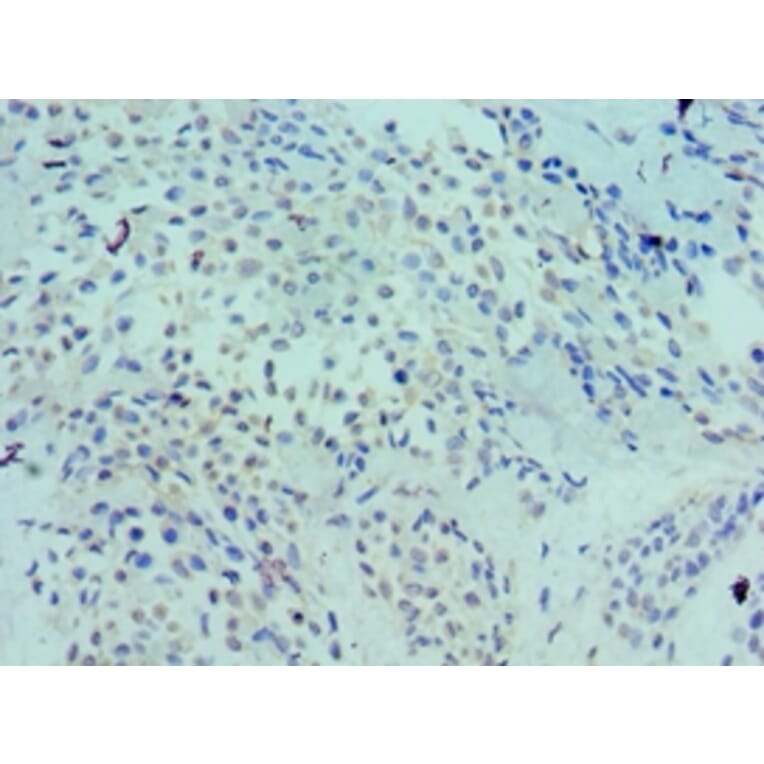 Immunohistochemistry - LRP6 Polyclonal Antibody from Signalway Antibody (42243) - Antibodies.com