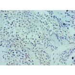 Immunohistochemistry - LRP6 Polyclonal Antibody from Signalway Antibody (42243) - Antibodies.com