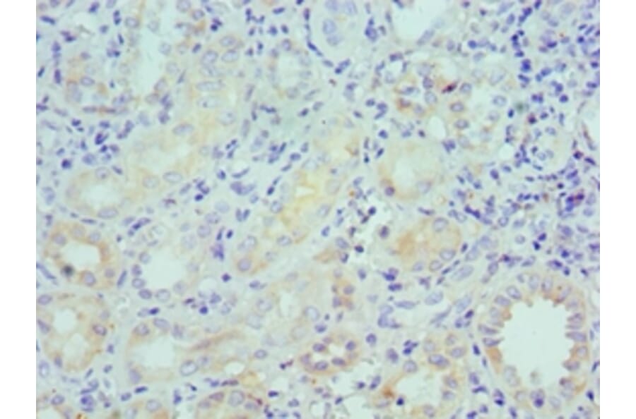 Immunohistochemistry - LRP6 Polyclonal Antibody from Signalway Antibody (42243) - Antibodies.com