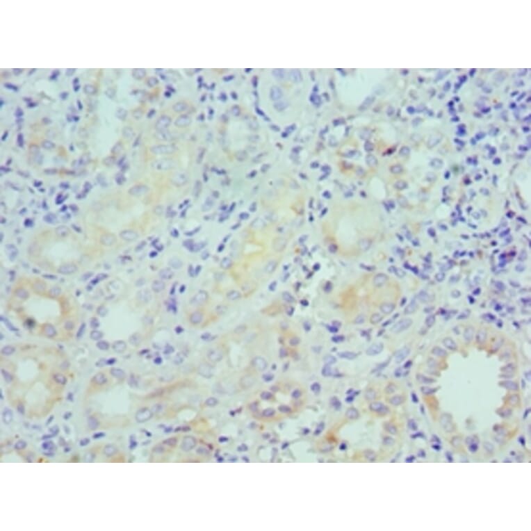 Immunohistochemistry - LRP6 Polyclonal Antibody from Signalway Antibody (42243) - Antibodies.com