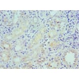 Immunohistochemistry - LRP6 Polyclonal Antibody from Signalway Antibody (42243) - Antibodies.com
