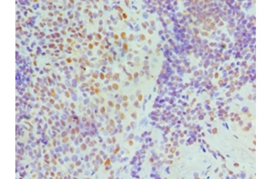 Immunohistochemistry - NONO Polyclonal Antibody from Signalway Antibody (42655) - Antibodies.com
