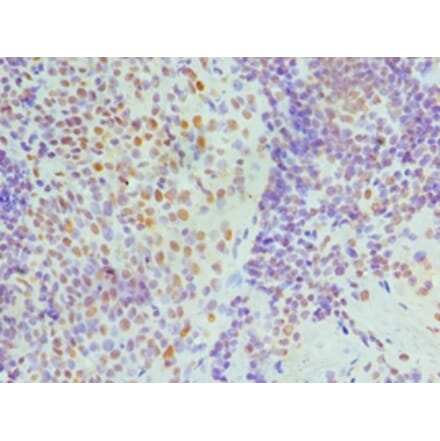 Immunohistochemistry - NONO Polyclonal Antibody from Signalway Antibody (42655) - Antibodies.com