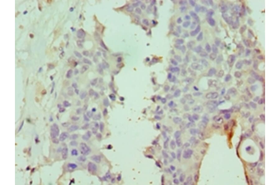 Immunohistochemistry - DPP8 Polyclonal Antibody from Signalway Antibody (42659) - Antibodies.com