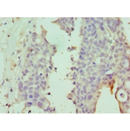 Immunohistochemistry - DPP8 Polyclonal Antibody from Signalway Antibody (42659) - Antibodies.com