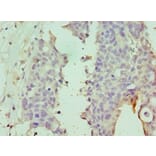 Immunohistochemistry - DPP8 Polyclonal Antibody from Signalway Antibody (42659) - Antibodies.com