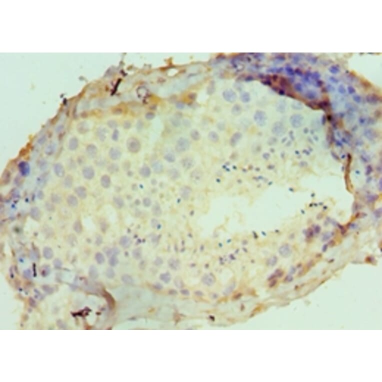 Immunohistochemistry - DPP8 Polyclonal Antibody from Signalway Antibody (42659) - Antibodies.com