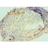 Immunohistochemistry - DPP8 Polyclonal Antibody from Signalway Antibody (42659) - Antibodies.com