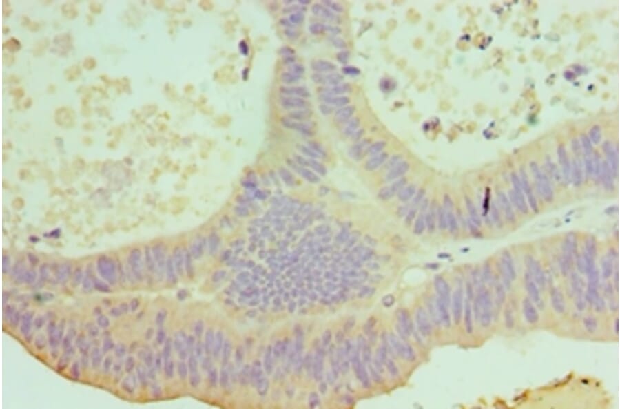 Immunohistochemistry - IL22 Polyclonal Antibody from Signalway Antibody (42680) - Antibodies.com