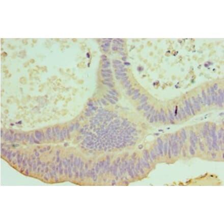 Immunohistochemistry - IL22 Polyclonal Antibody from Signalway Antibody (42680) - Antibodies.com