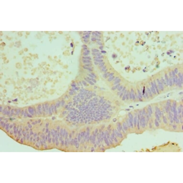 Immunohistochemistry - IL22 Polyclonal Antibody from Signalway Antibody (42680) - Antibodies.com