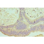 Immunohistochemistry - IL22 Polyclonal Antibody from Signalway Antibody (42680) - Antibodies.com
