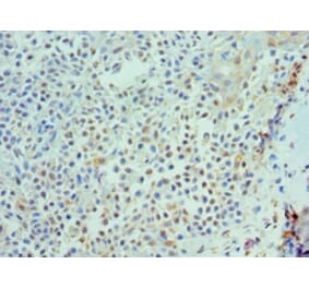 Immunohistochemistry - IL21 Polyclonal Antibody from Signalway Antibody (42683) - Antibodies.com