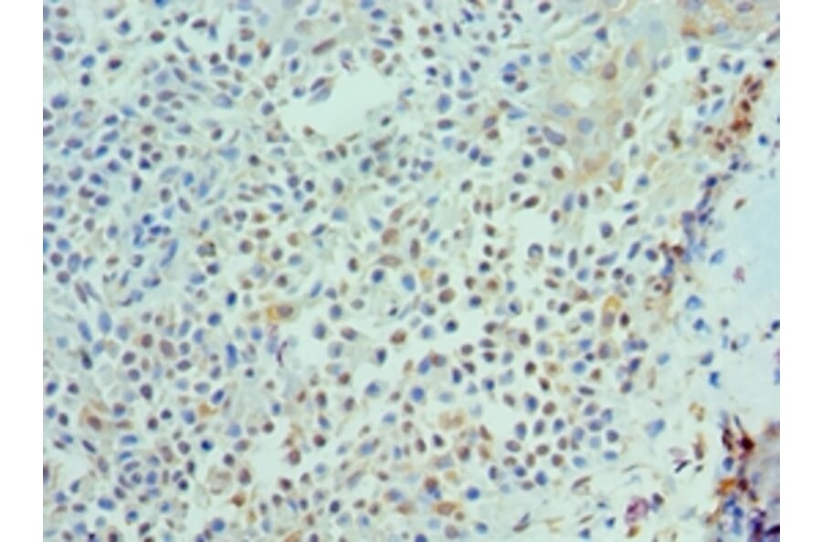 Immunohistochemistry - IL21 Polyclonal Antibody from Signalway Antibody (42683) - Antibodies.com