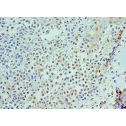 Immunohistochemistry - IL21 Polyclonal Antibody from Signalway Antibody (42683) - Antibodies.com