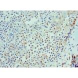 Immunohistochemistry - IL21 Polyclonal Antibody from Signalway Antibody (42683) - Antibodies.com