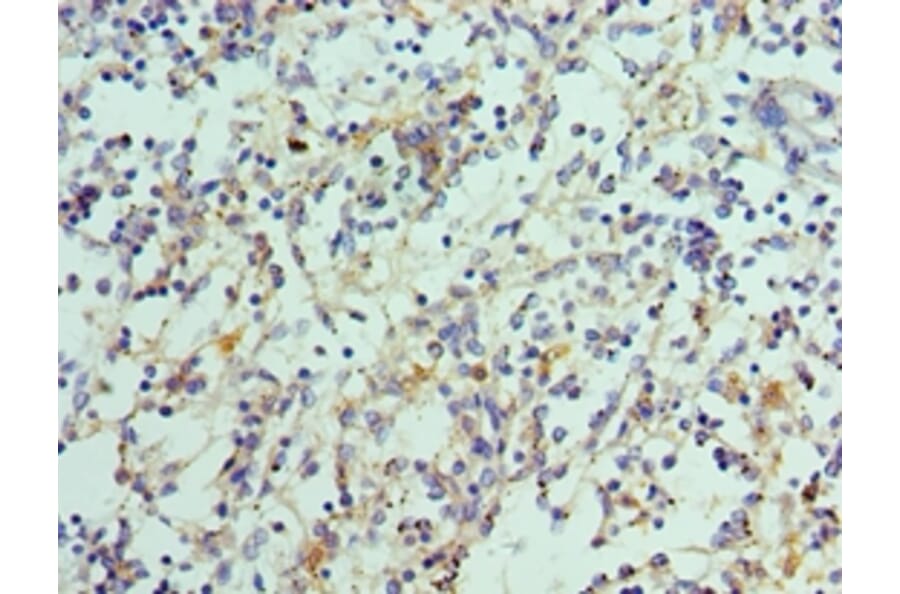 Immunohistochemistry - IL21 Polyclonal Antibody from Signalway Antibody (42683) - Antibodies.com