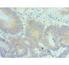 Immunohistochemistry - PLK2 Polyclonal Antibody from Signalway Antibody (42689) - Antibodies.com