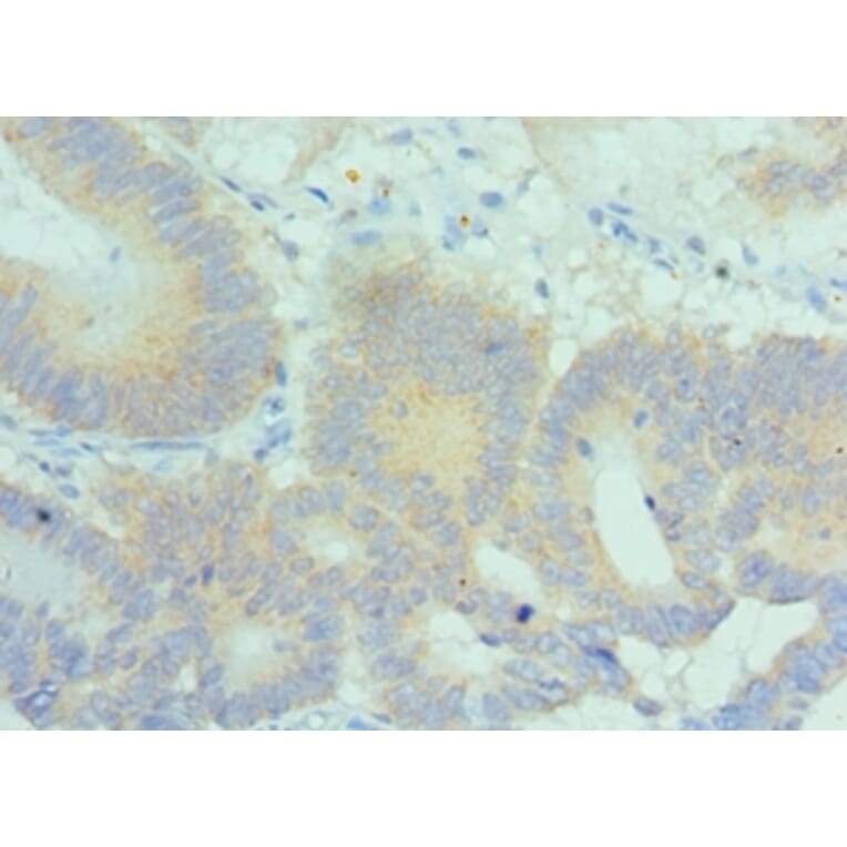 Immunohistochemistry - PLK2 Polyclonal Antibody from Signalway Antibody (42689) - Antibodies.com
