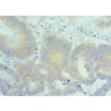 Immunohistochemistry - PLK2 Polyclonal Antibody from Signalway Antibody (42689) - Antibodies.com