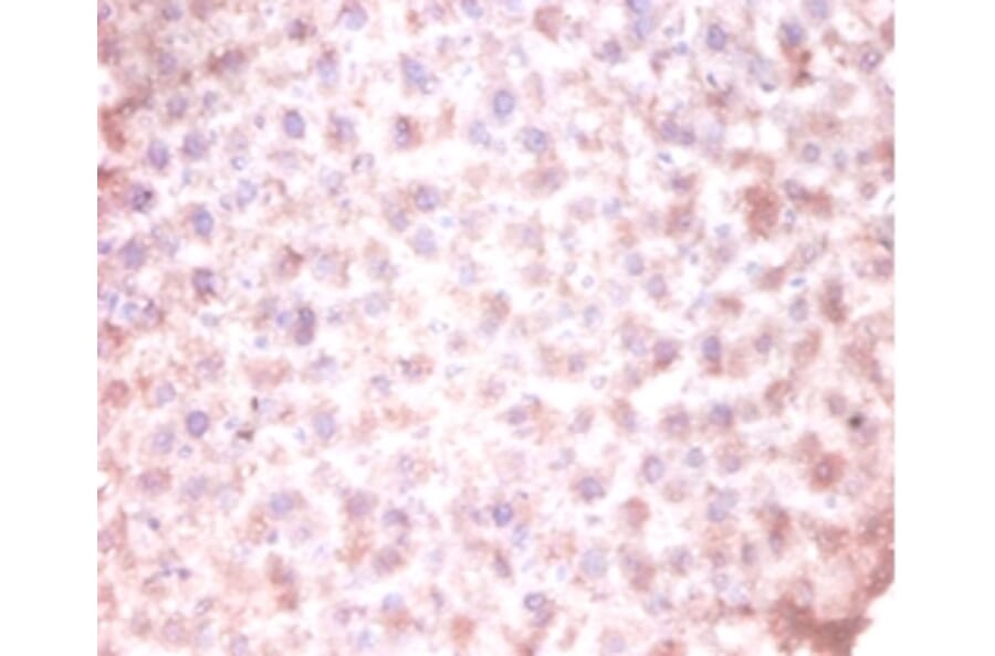 Immunohistochemistry - CDKN2AIP N-terminal-like protein Polyclonal Antibody from Signalway Antibody (42115)