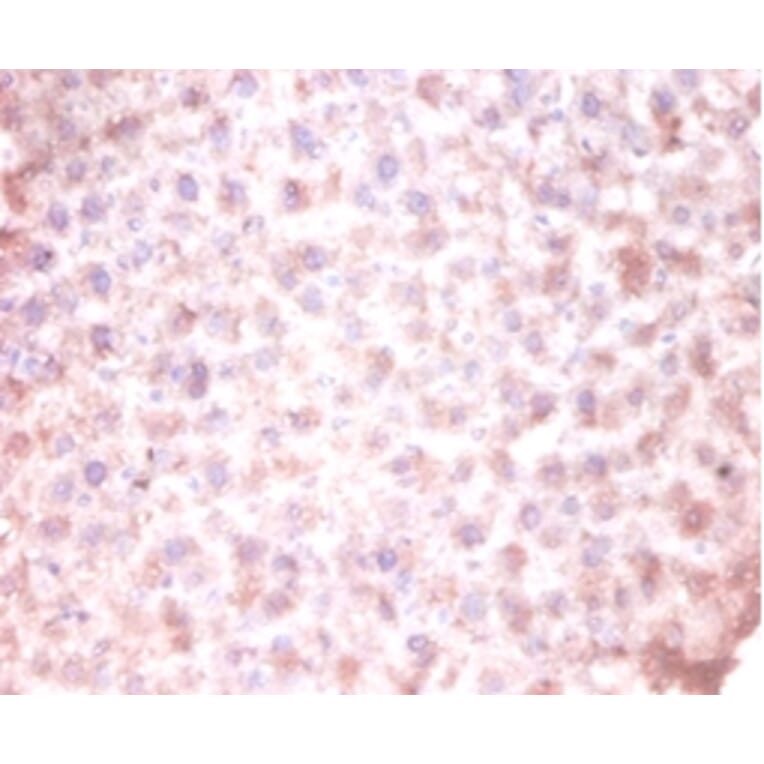 Immunohistochemistry - CDKN2AIP N-terminal-like protein Polyclonal Antibody from Signalway Antibody (42115)