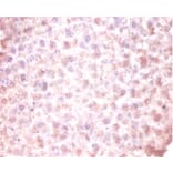 Immunohistochemistry - CDKN2AIP N-terminal-like protein Polyclonal Antibody from Signalway Antibody (42115)