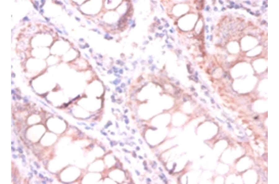 Immunohistochemistry - CDKN2AIP N-terminal-like protein Polyclonal Antibody from Signalway Antibody (42115)
