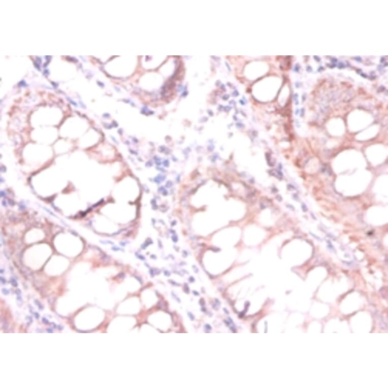 Immunohistochemistry - CDKN2AIP N-terminal-like protein Polyclonal Antibody from Signalway Antibody (42115)