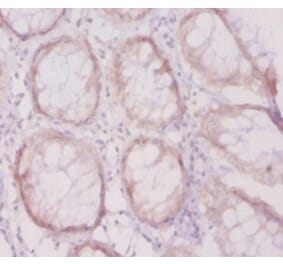 Immunohistochemistry - Vascular cell adhesion protein 1 Polyclonal Antibody from Signalway Antibody (42485)