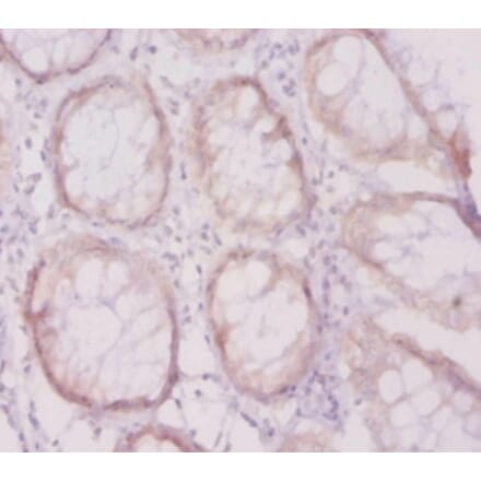 Immunohistochemistry - Vascular cell adhesion protein 1 Polyclonal Antibody from Signalway Antibody (42485)