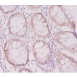 Immunohistochemistry - Vascular cell adhesion protein 1 Polyclonal Antibody from Signalway Antibody (42485)