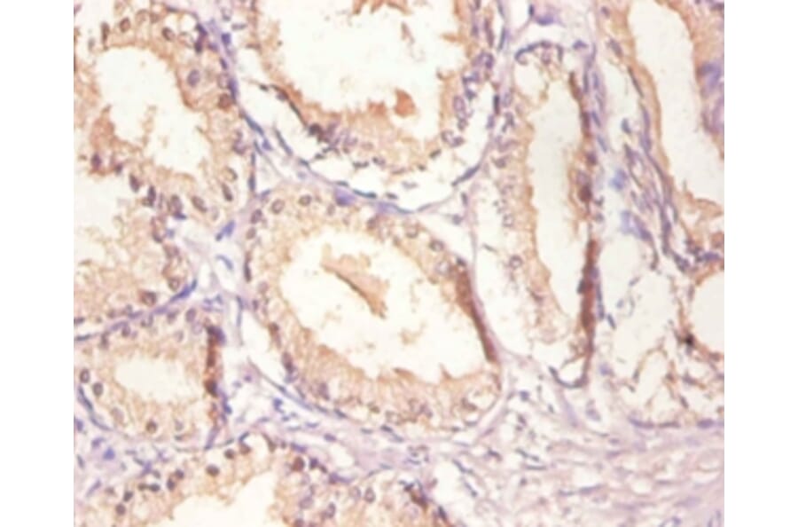Immunohistochemistry - Epidermal growth factor receptor Polyclonal Antibody from Signalway Antibody (42520)