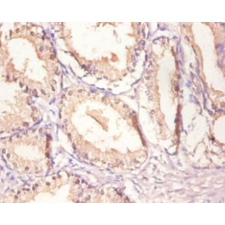 Immunohistochemistry - Epidermal growth factor receptor Polyclonal Antibody from Signalway Antibody (42520)