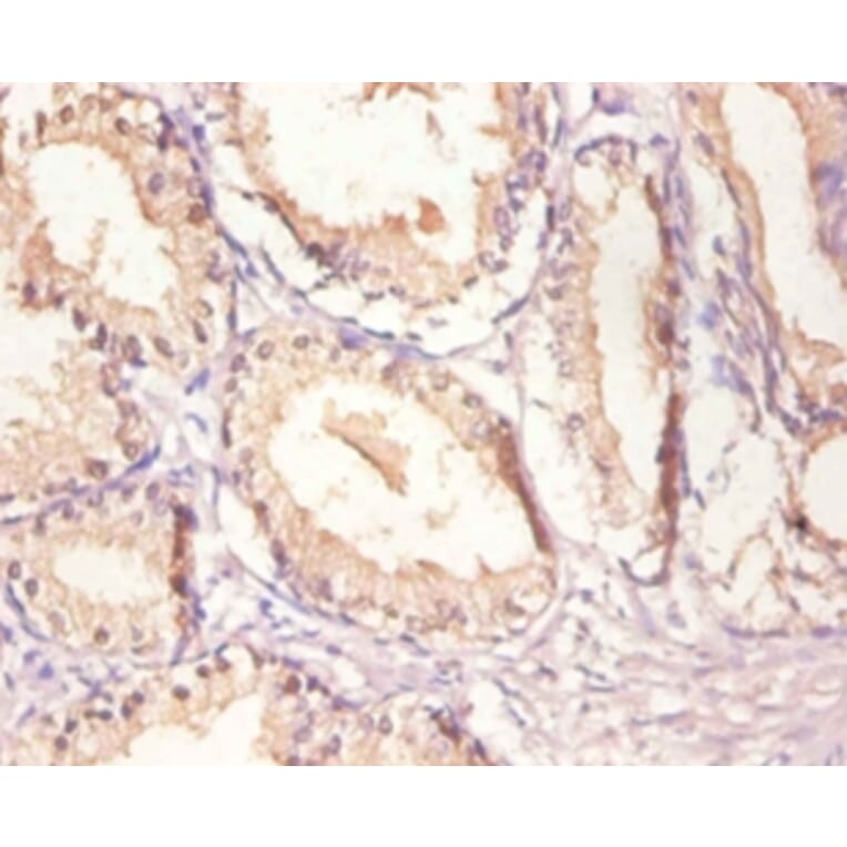 Immunohistochemistry - Epidermal growth factor receptor Polyclonal Antibody from Signalway Antibody (42520)