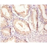 Immunohistochemistry - Epidermal growth factor receptor Polyclonal Antibody from Signalway Antibody (42520)
