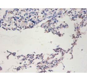 Immunohistochemistry - Telomerase reverse transcriptase Polyclonal Antibody from Signalway Antibody (42529)