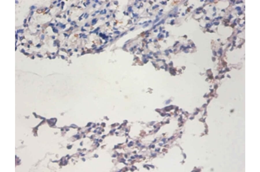 Immunohistochemistry - Telomerase reverse transcriptase Polyclonal Antibody from Signalway Antibody (42529)