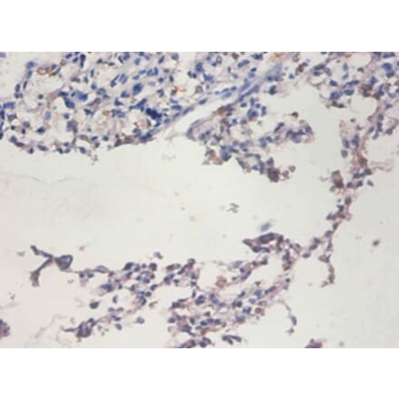 Immunohistochemistry - Telomerase reverse transcriptase Polyclonal Antibody from Signalway Antibody (42529)