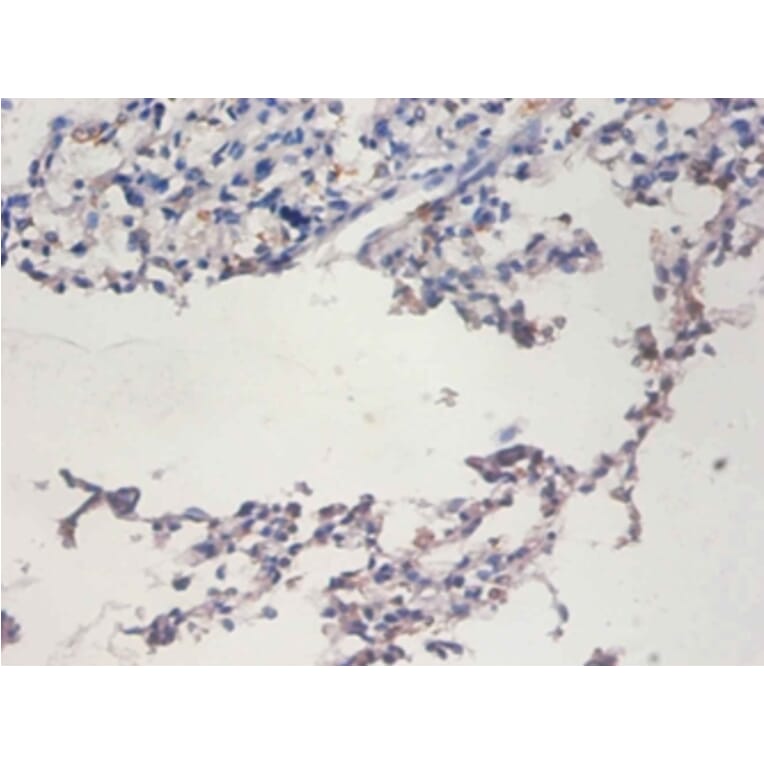 Immunohistochemistry - Telomerase reverse transcriptase Polyclonal Antibody from Signalway Antibody (42529)