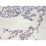 Immunohistochemistry - Telomerase reverse transcriptase Polyclonal Antibody from Signalway Antibody (42529)