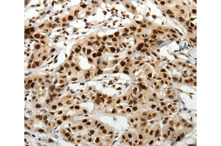 Immunohistochemistry - SCN1A/2A/3A/4A/5A/8A/9A/10A/11A/12A Antibody from Signalway Antibody (37231) - Antibodies.com