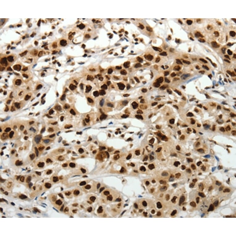 Immunohistochemistry - SCN1A/2A/3A/4A/5A/8A/9A/10A/11A/12A Antibody from Signalway Antibody (37231) - Antibodies.com